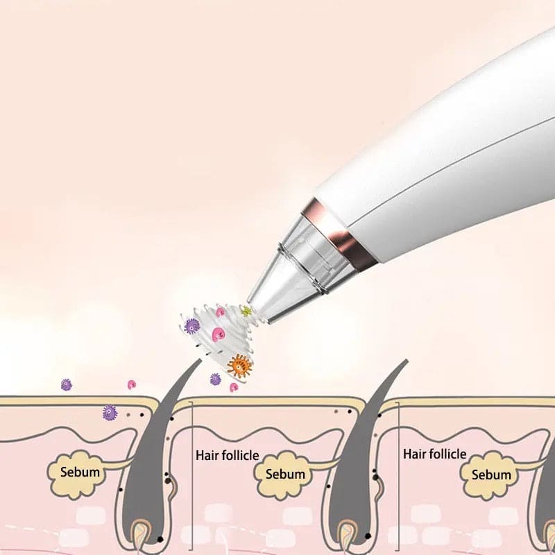 Electric Vacuum Pore Cleaner, 6 In 1 Blackheads Removing Device, Facial Black Spots White Dot Pimple Acne Cleaner, Beauty Extractor Skin Care Tools, Black Point Vacuum Suction Device, USB Rechargeable Bubble Beauty Instrument Electric Vacuum Pore Cleaner, 6 In 1 Blackheads Removing Device, Facial Black Spots White Dot Pimple Acne Cleaner, Beauty Extractor Skin Care Tools, Black Point Vacuum Suction Device, USB Rechargeable Bubble Beauty Instrument